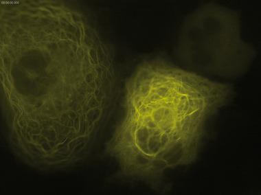 徠卡顯微鏡TIRF在生命科學研究中的應用