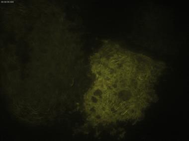 徠卡顯微鏡TIRF在生命科學研究中的應用