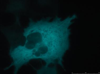 徠卡顯微鏡TIRF在生命科學研究中的應用