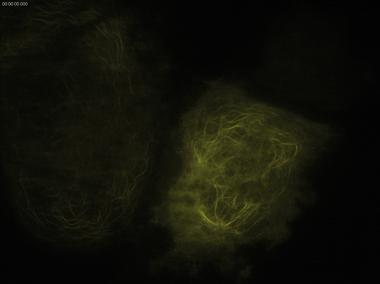 徠卡顯微鏡TIRF在生命科學研究中的應用